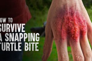 How To Survive A Snapping Turtle Bite 3